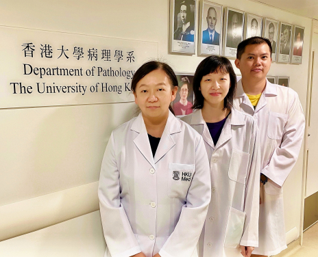 Dr Judy Yam Wai-ping, Associate Professor of the Department of Pathology, HKUMed (left), with her research team members, Dr Tey Sze-keong, Post-doctoral Fellow (right) and Ms Cherlie Yeung Lot-sum, Research Assistant (middle).
